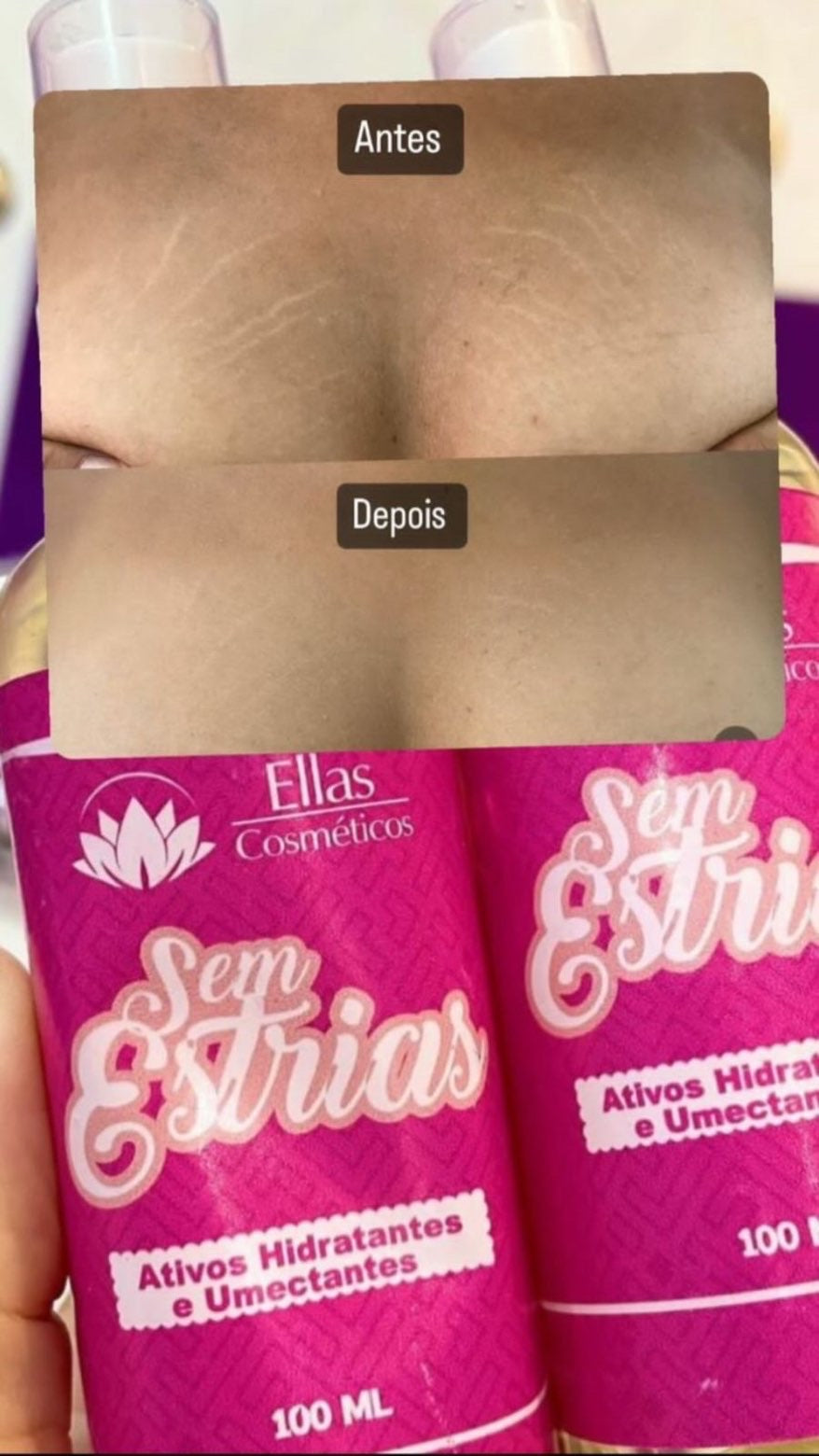 Crème Corporelle Sem Estria – Prévention & Réduction des Vergetures - 100 ml