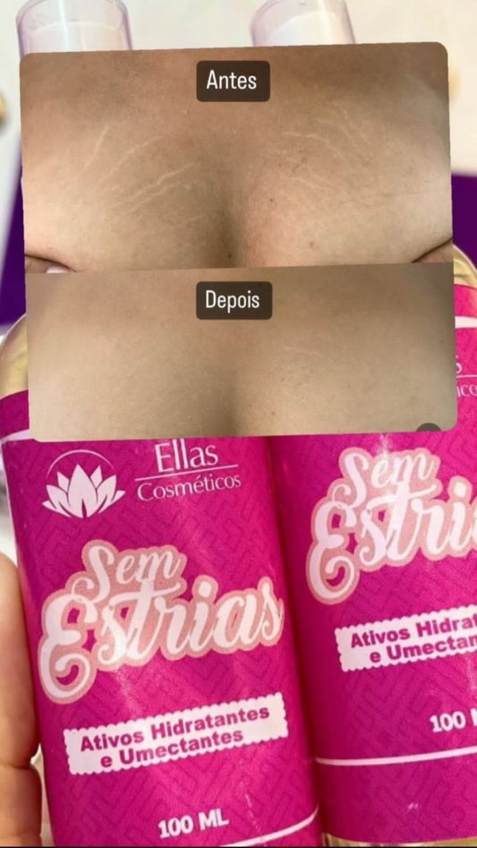 Crème Corporelle Sem Estria – Prévention & Réduction des Vergetures - 100 ml