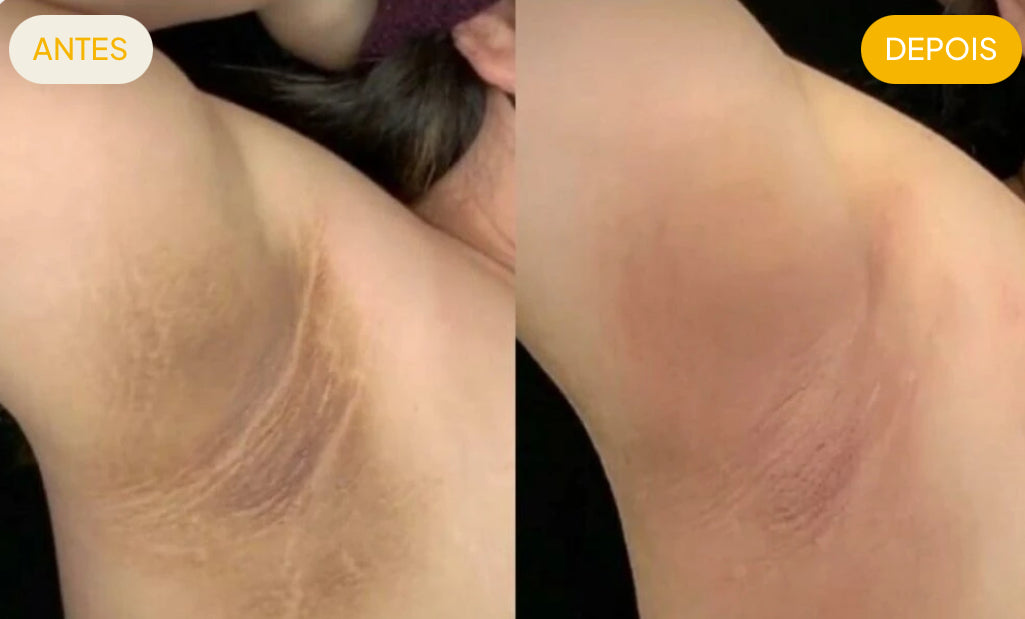 ADEUS Crème Banana Correctrice Anti-Taches