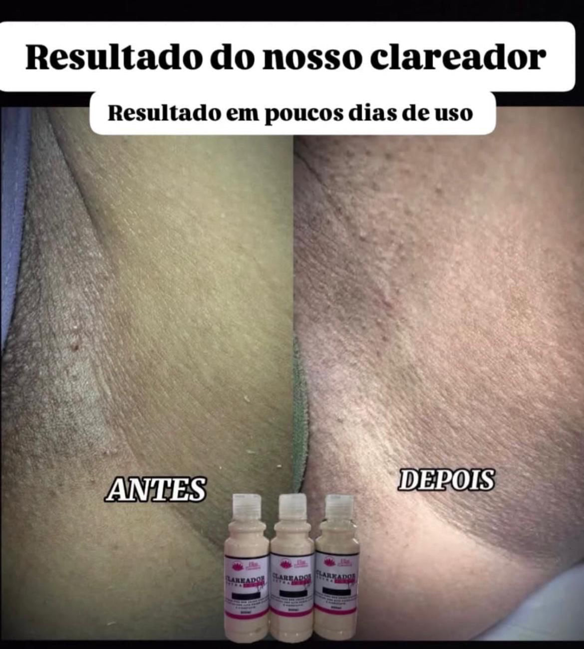 🌸 Crème Éclaircissante Extra Forte – Ellas Cosméticos (300 ml)