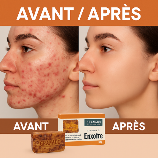 Savon de Souffre 🧼