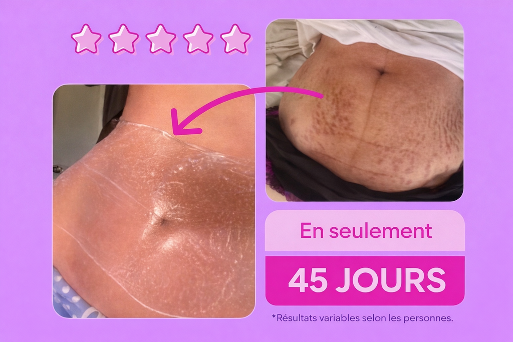 ADEUS-Crème Intensive Multifonctionnelle-Anti Vergetures,cellulite