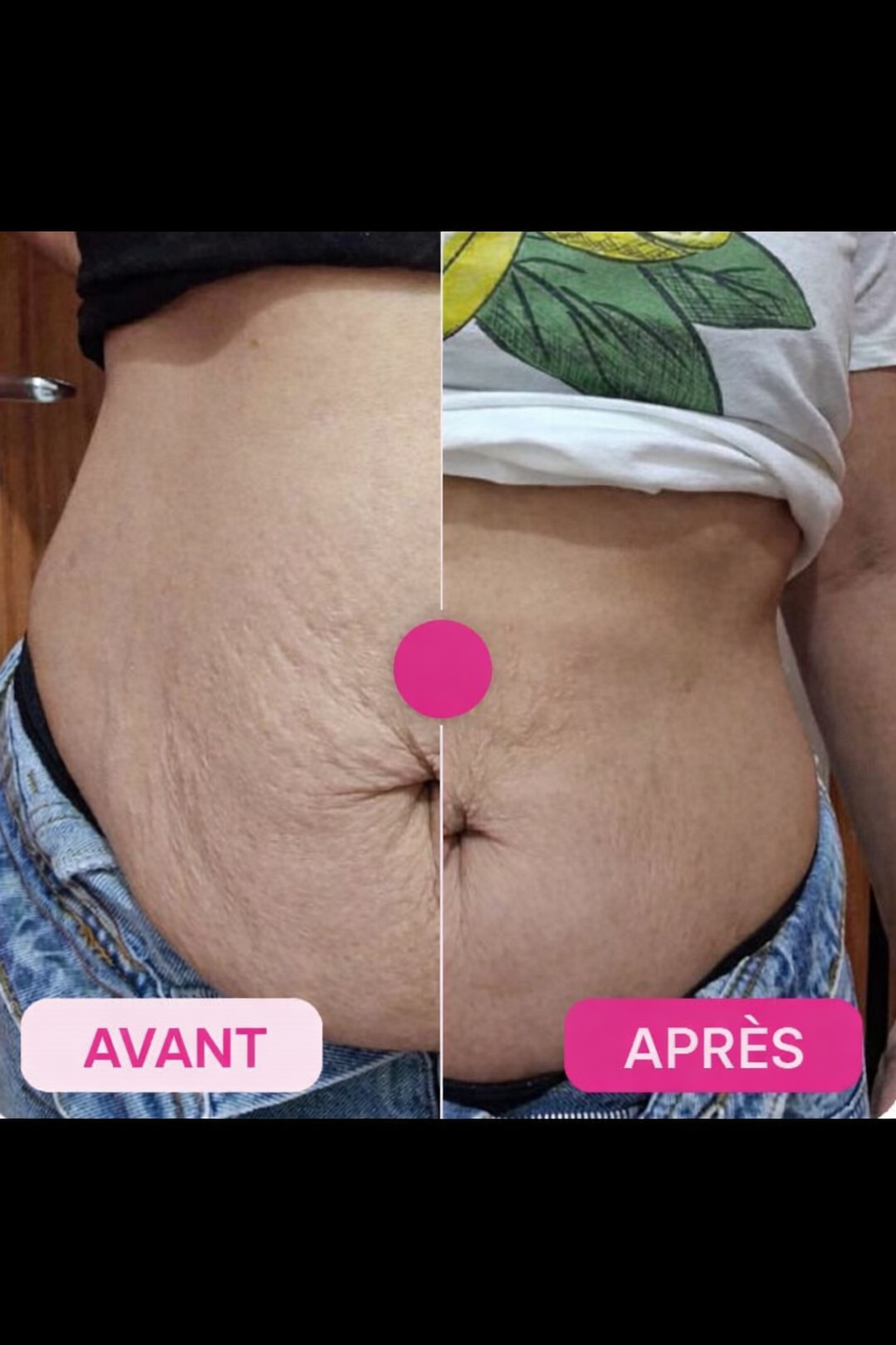 ADEUS-Crème Intensive Multifonctionnelle-Anti Vergetures,cellulite